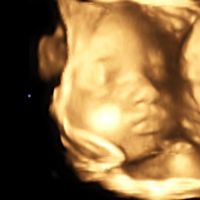 3D Ultraschall in der Schwangerschaft